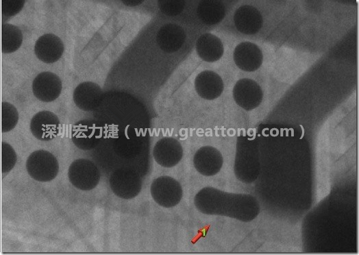 BGA因?yàn)楹笁|變小，造成錫膏過(guò)多而最終形成焊接短路的結(jié)果。